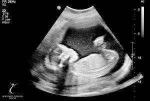 ultrasound 2014-12-10 06.jpg